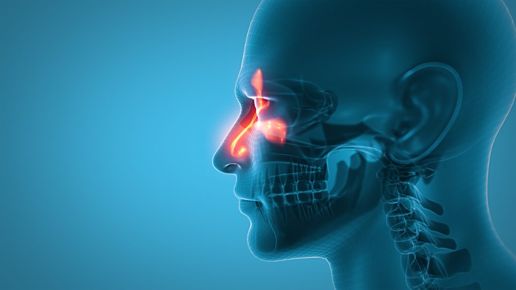 Sinus cavity concept