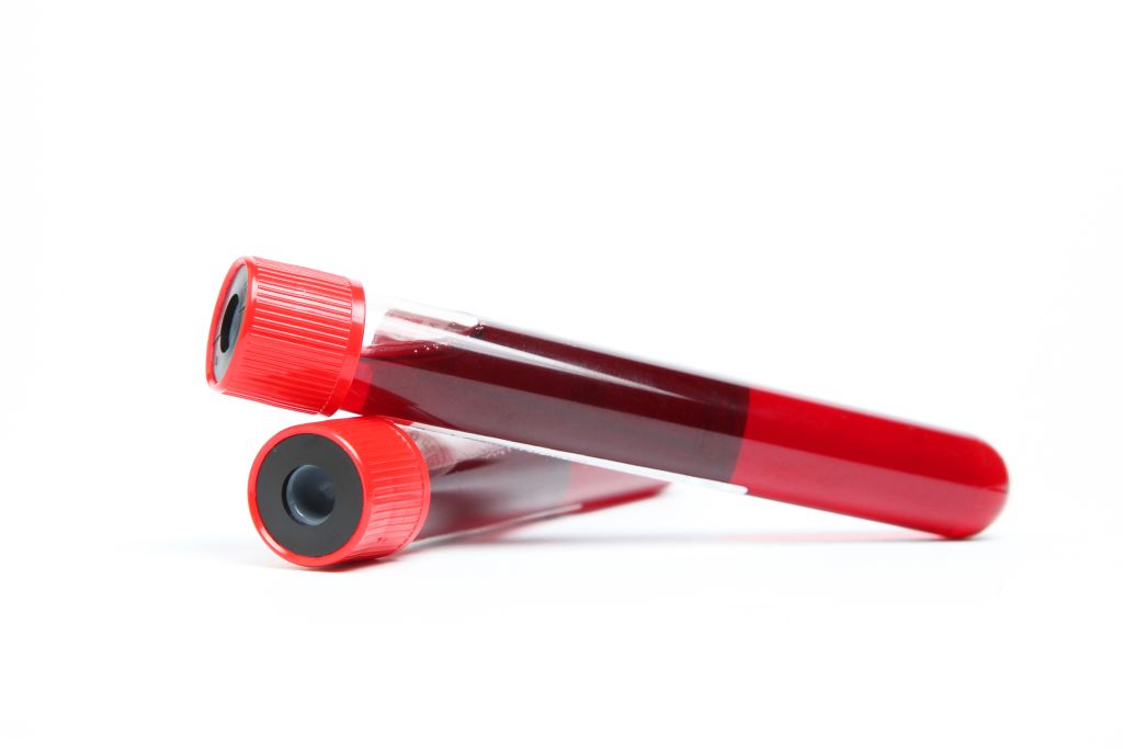 Blood sample