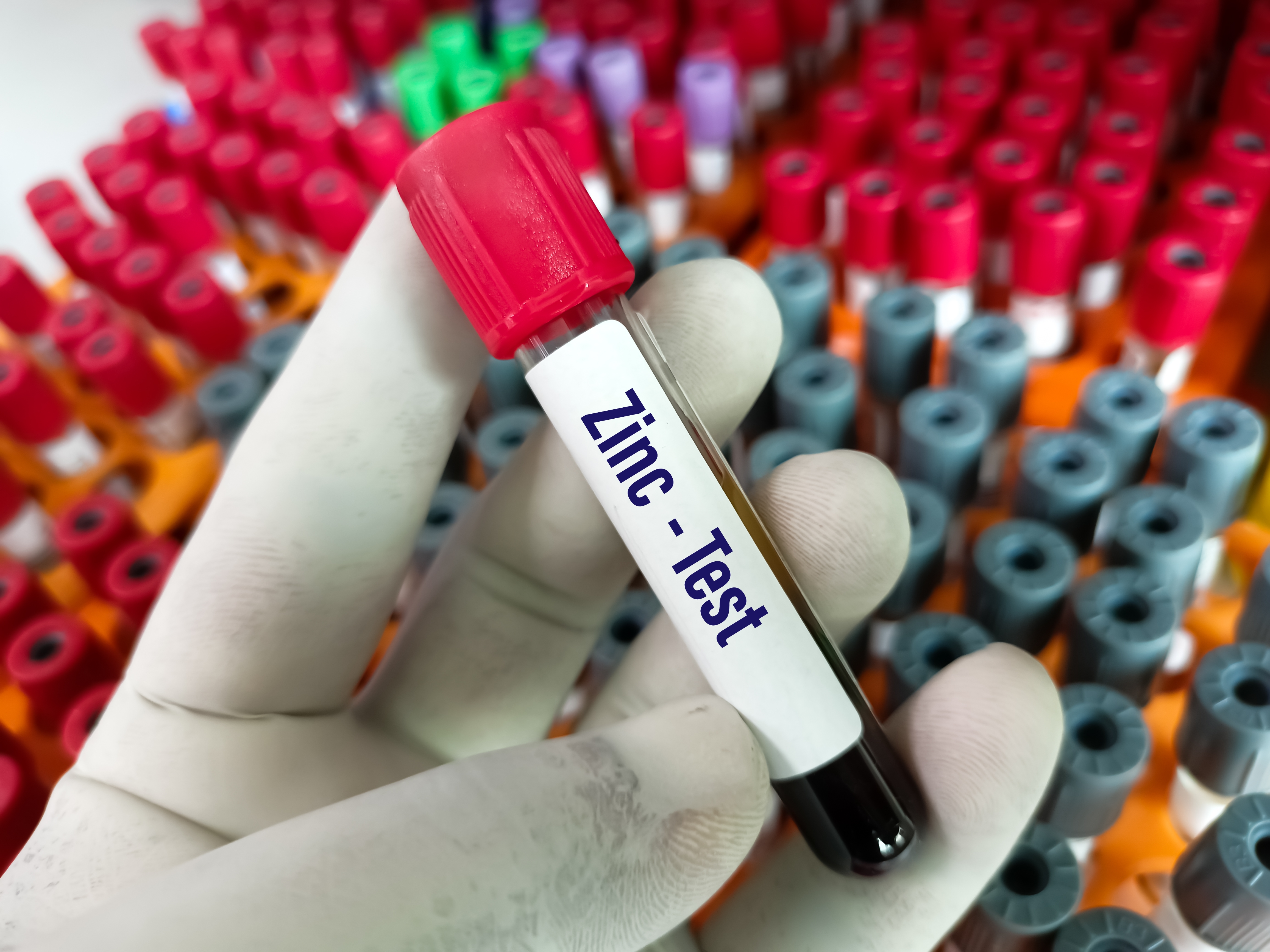 Zinc blood test   