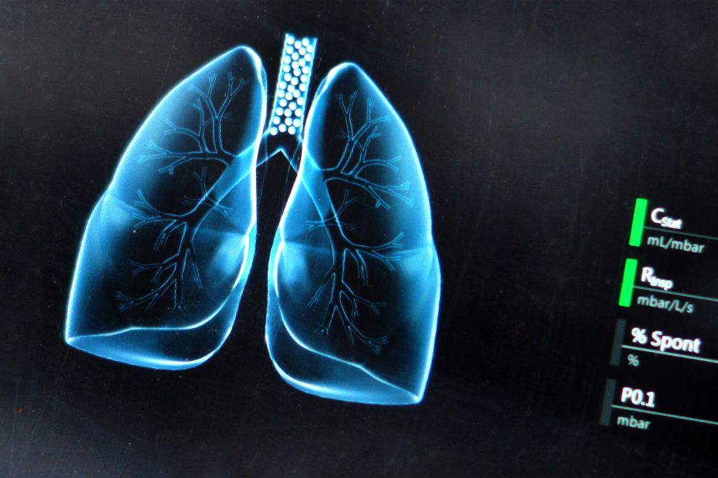 Lung scan 
