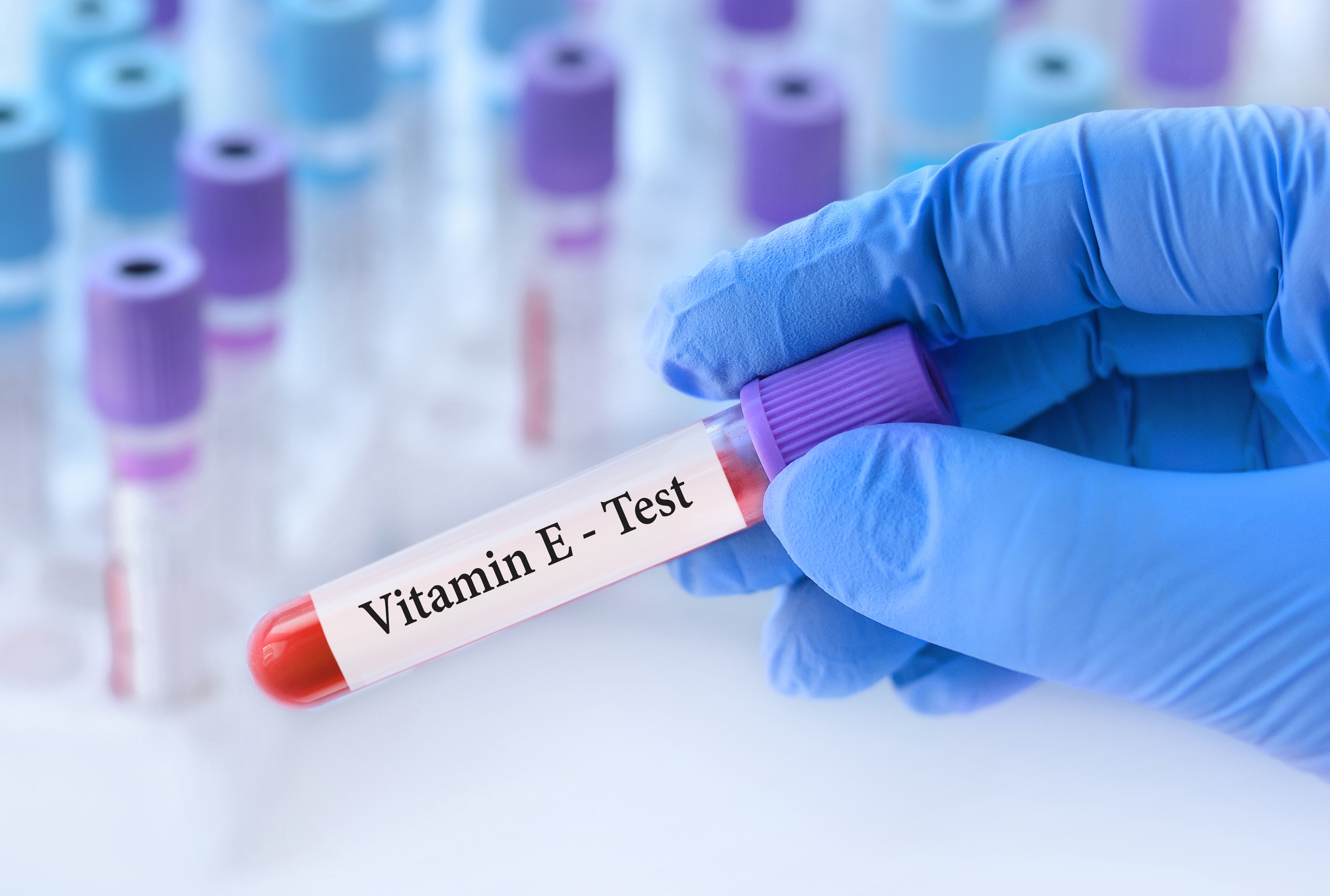 Vitamin E blood test  