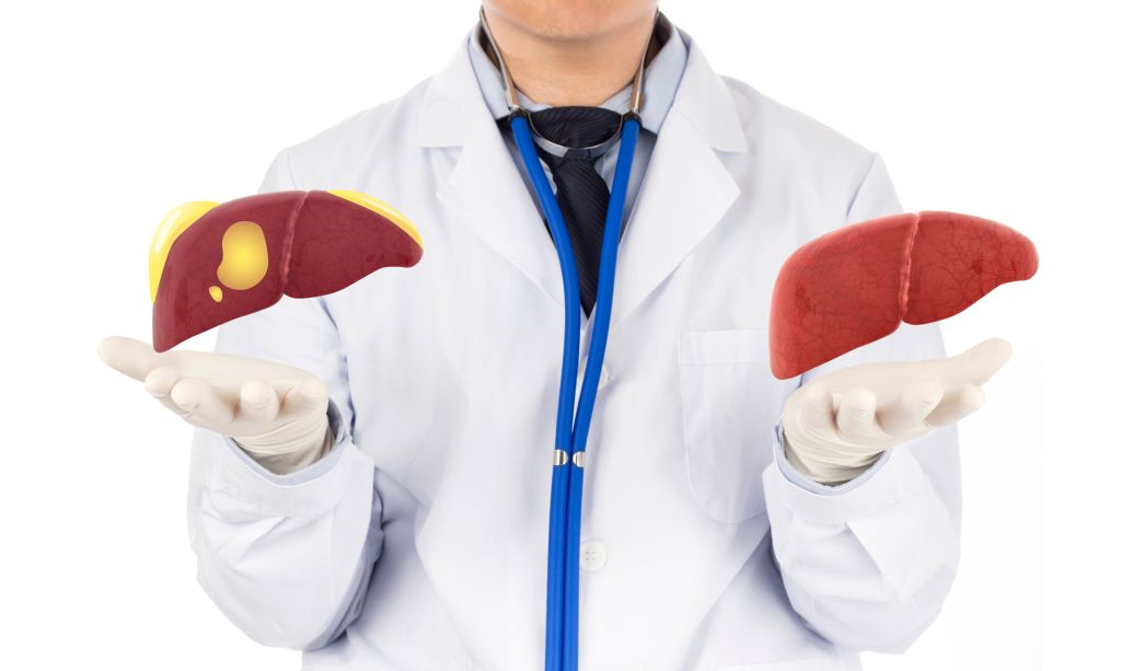 Fatty liver vs. healthy liver