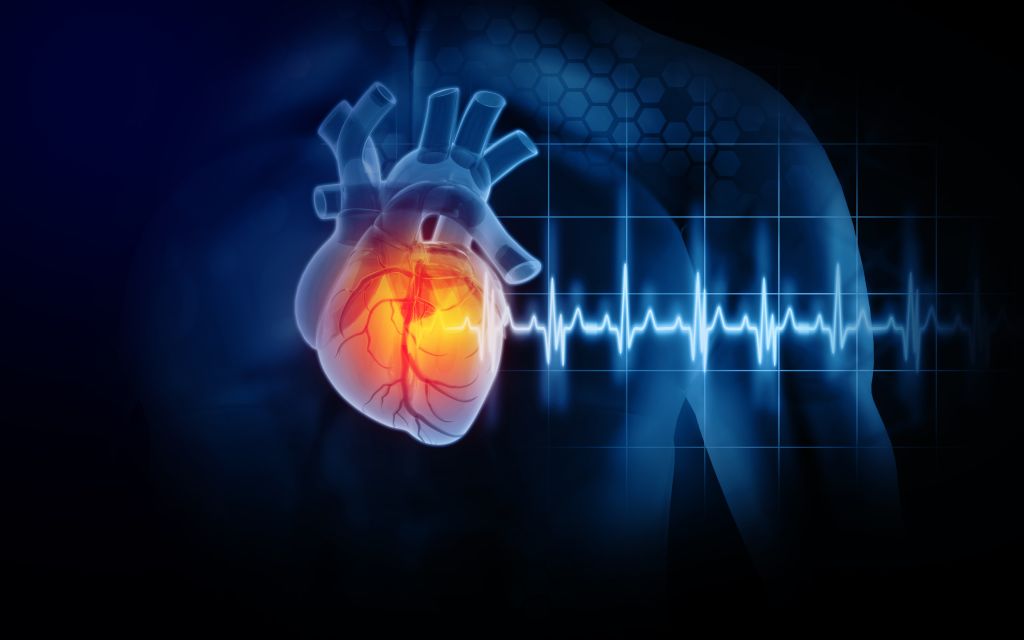 Palpitations graph