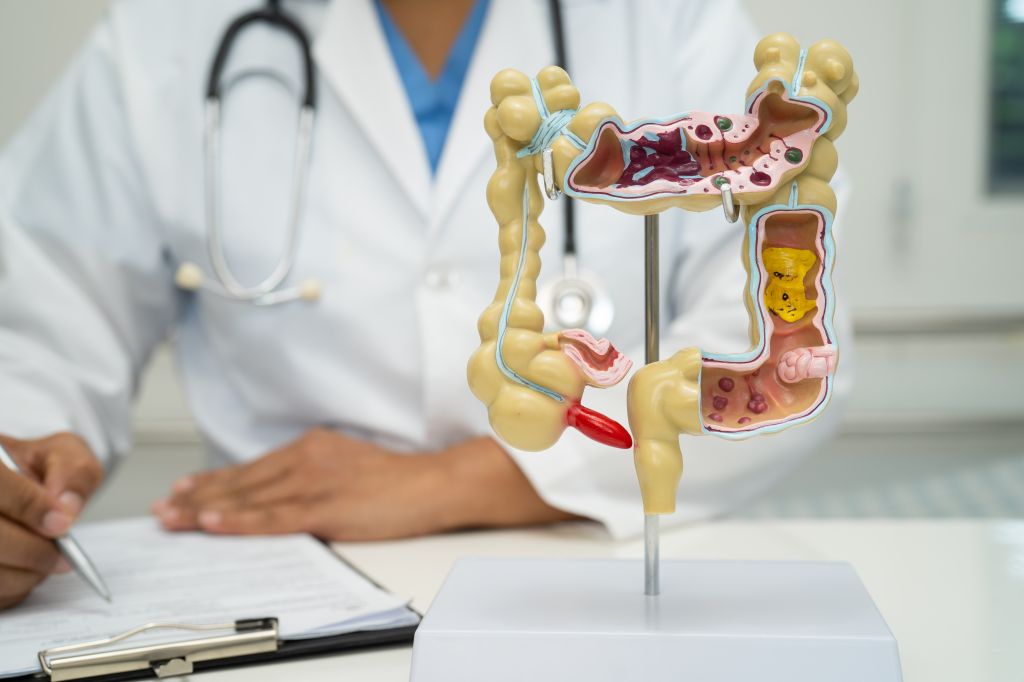 Gastroenterologist