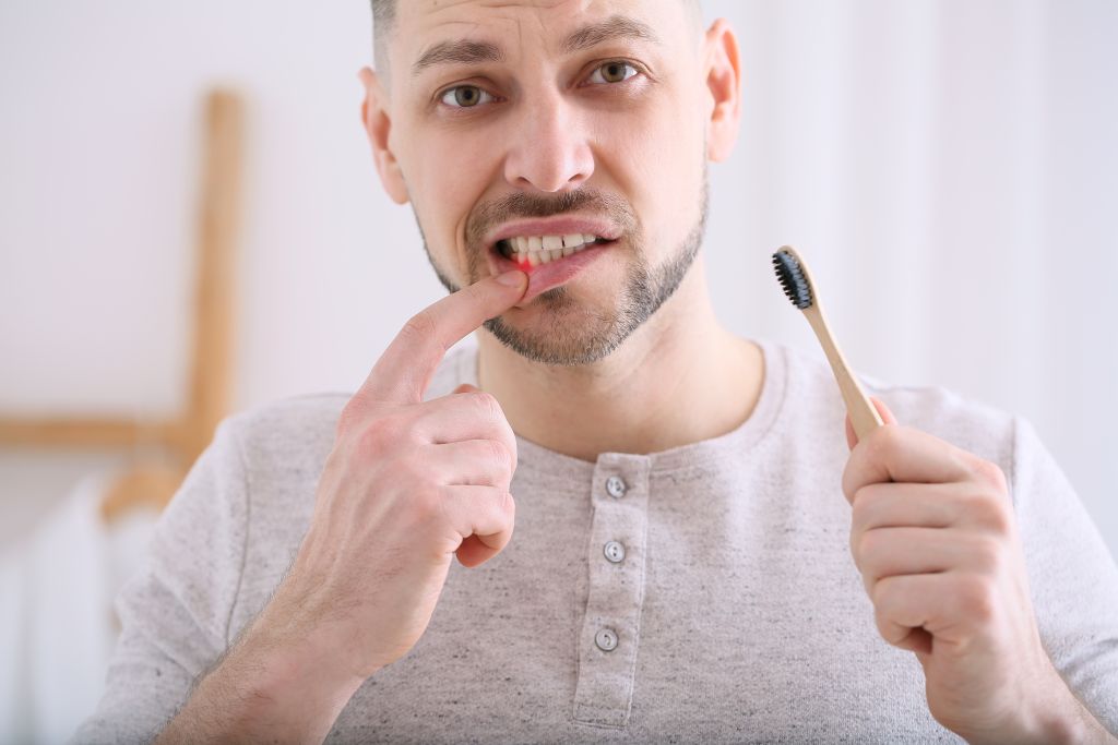 Man with bleeding gums 