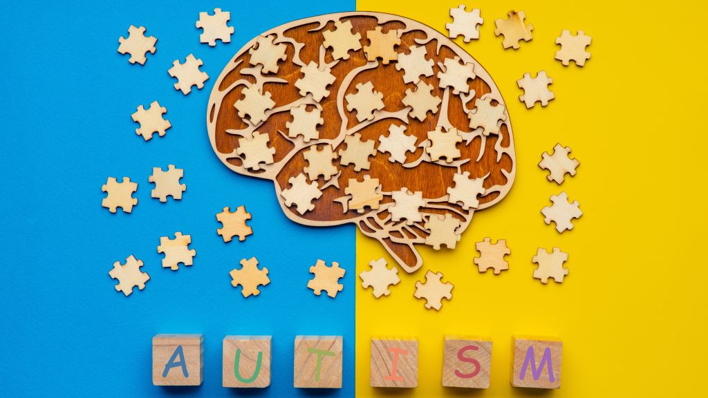 Brain puzzle concept    