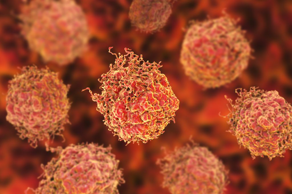 Prostate cancer management 