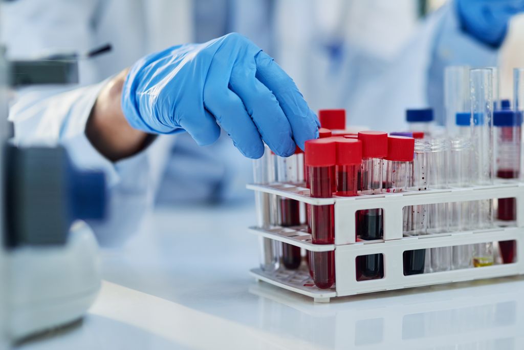 Blood test 