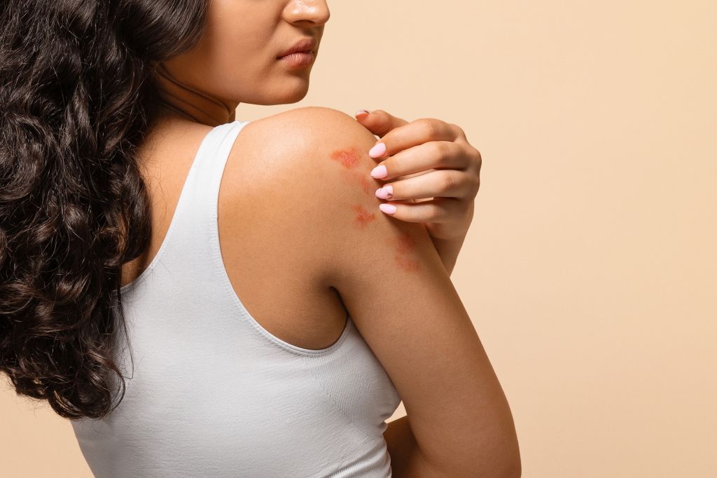Woman with itchy skin  