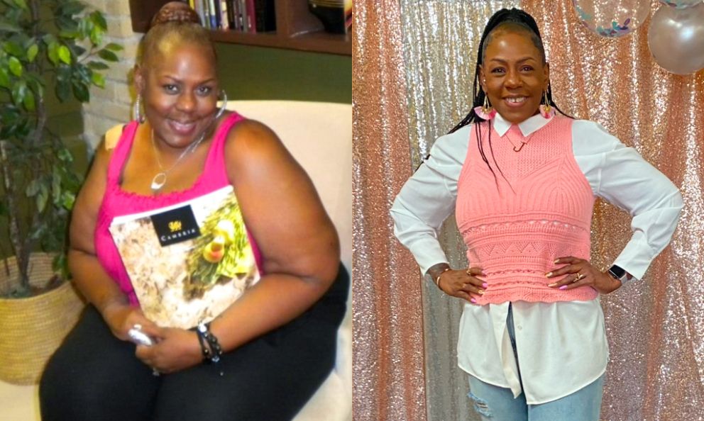 Before and after image of Joya Smith