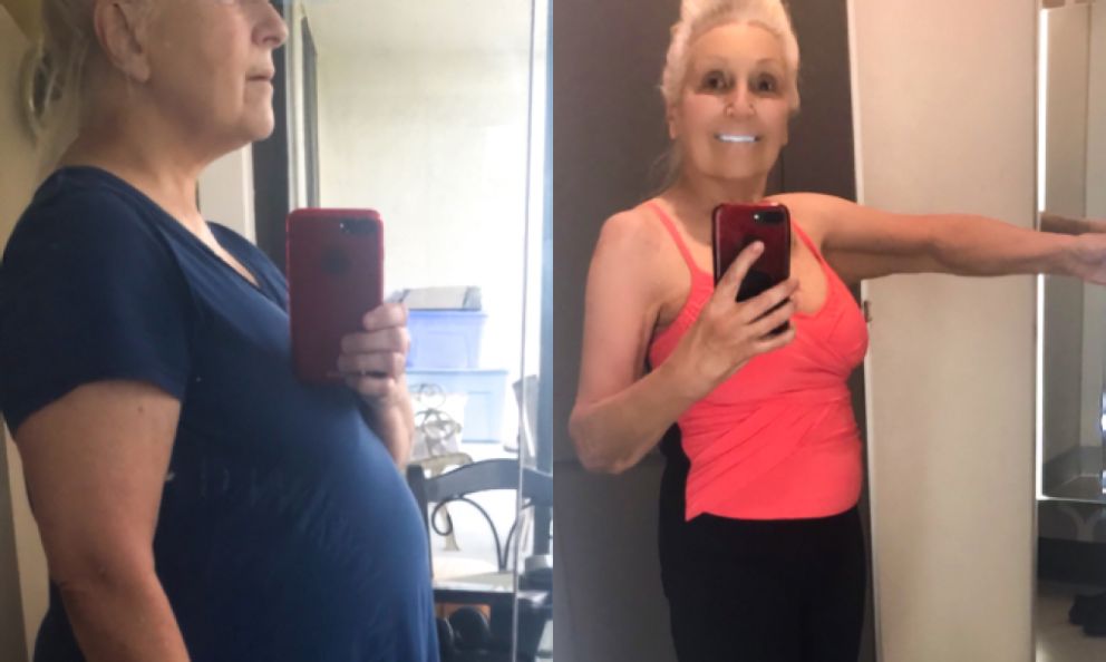 Karen Bell before and after image