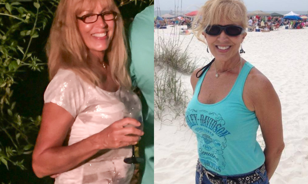 Before and after image of Sherry Neville