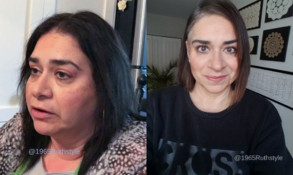 Before and after image of Ruth Hovsepian