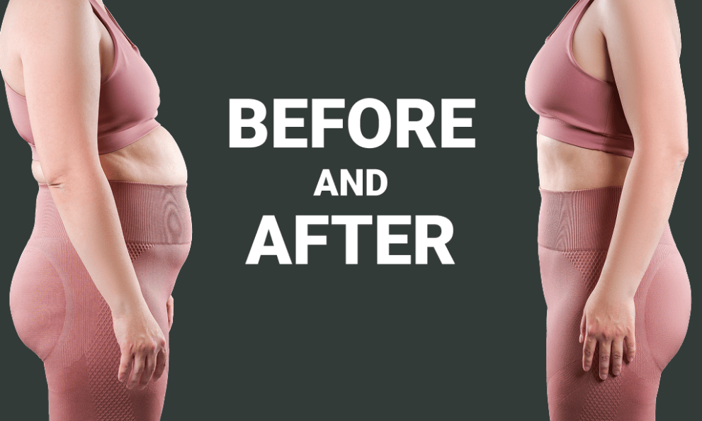 Weight loss transformation comparison image female