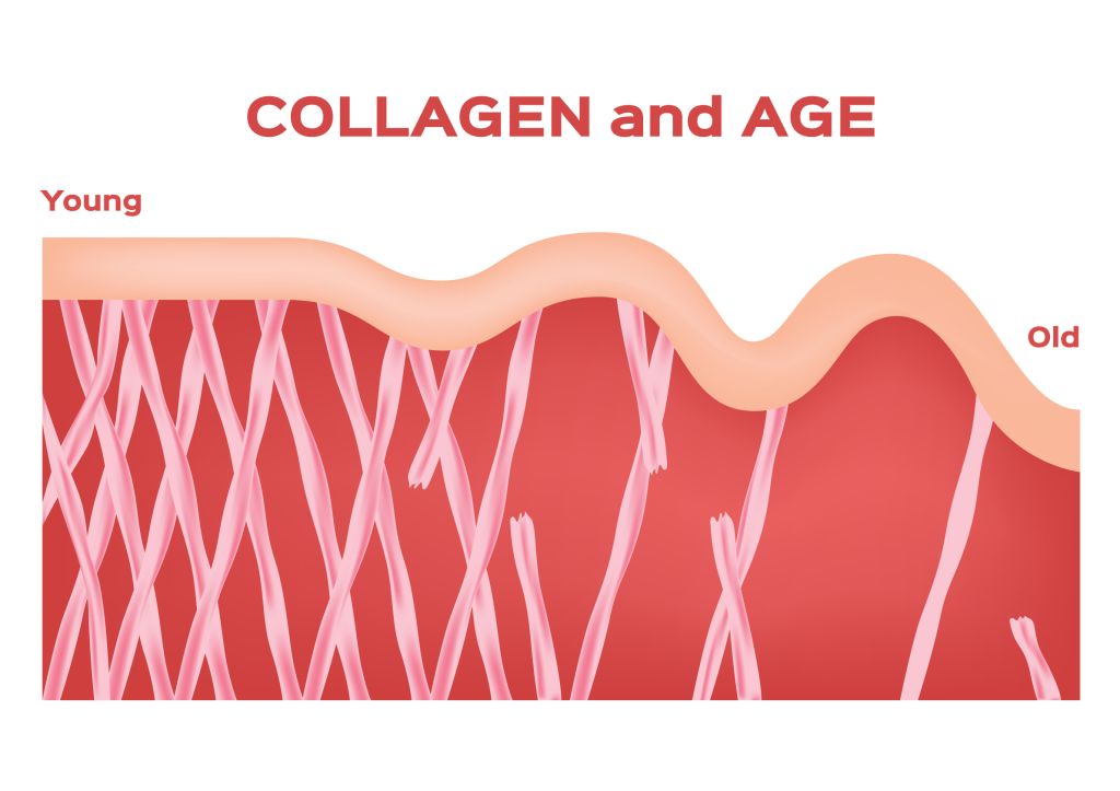 Collagen breakdown 