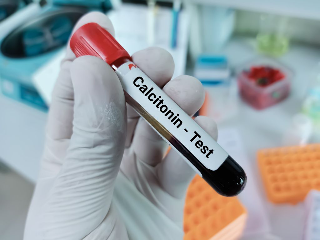 Calcitonin blood test 