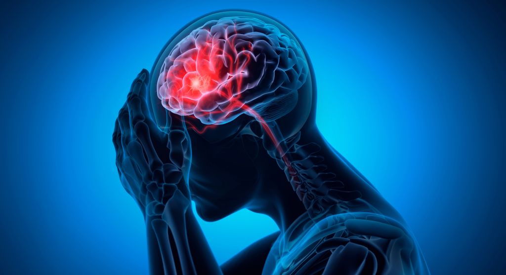 Headache illustration 