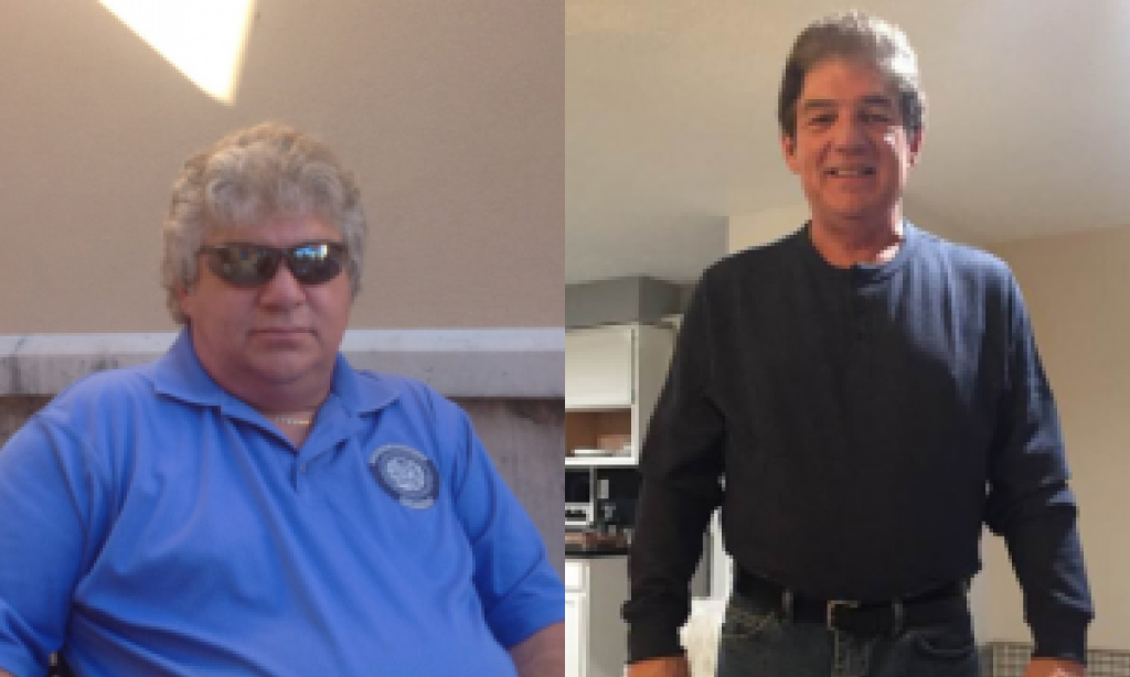 Before and after image of Carey Allen