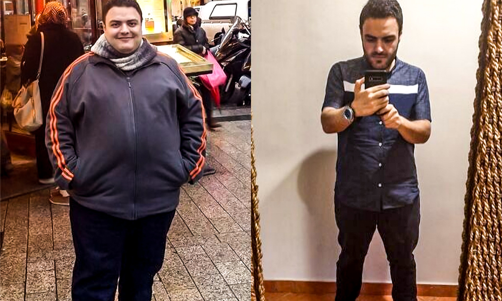 Before and after image of Karim Fares