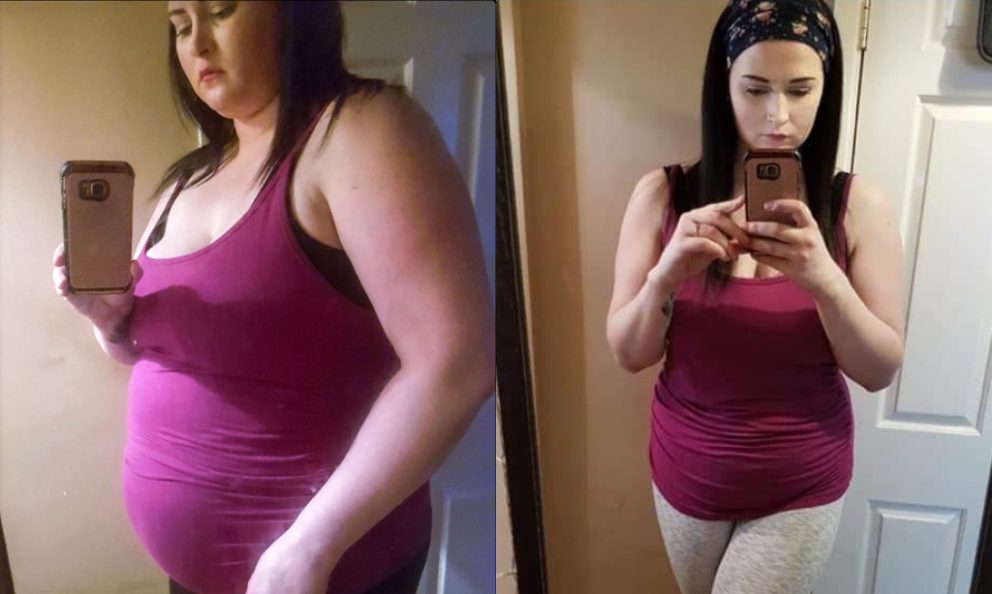 Before and after image of Anna Hope