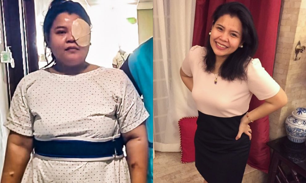 Before and after image of Lianne Bigornia