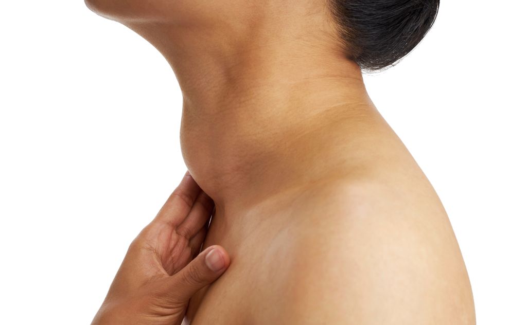 Woman with enlarged thyroid gland