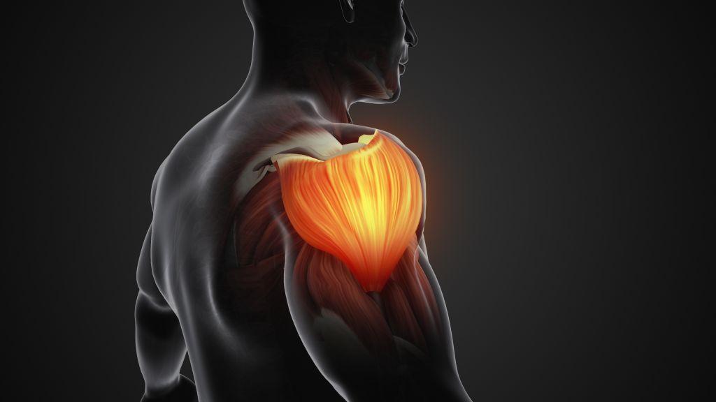 Muscle pain illustration